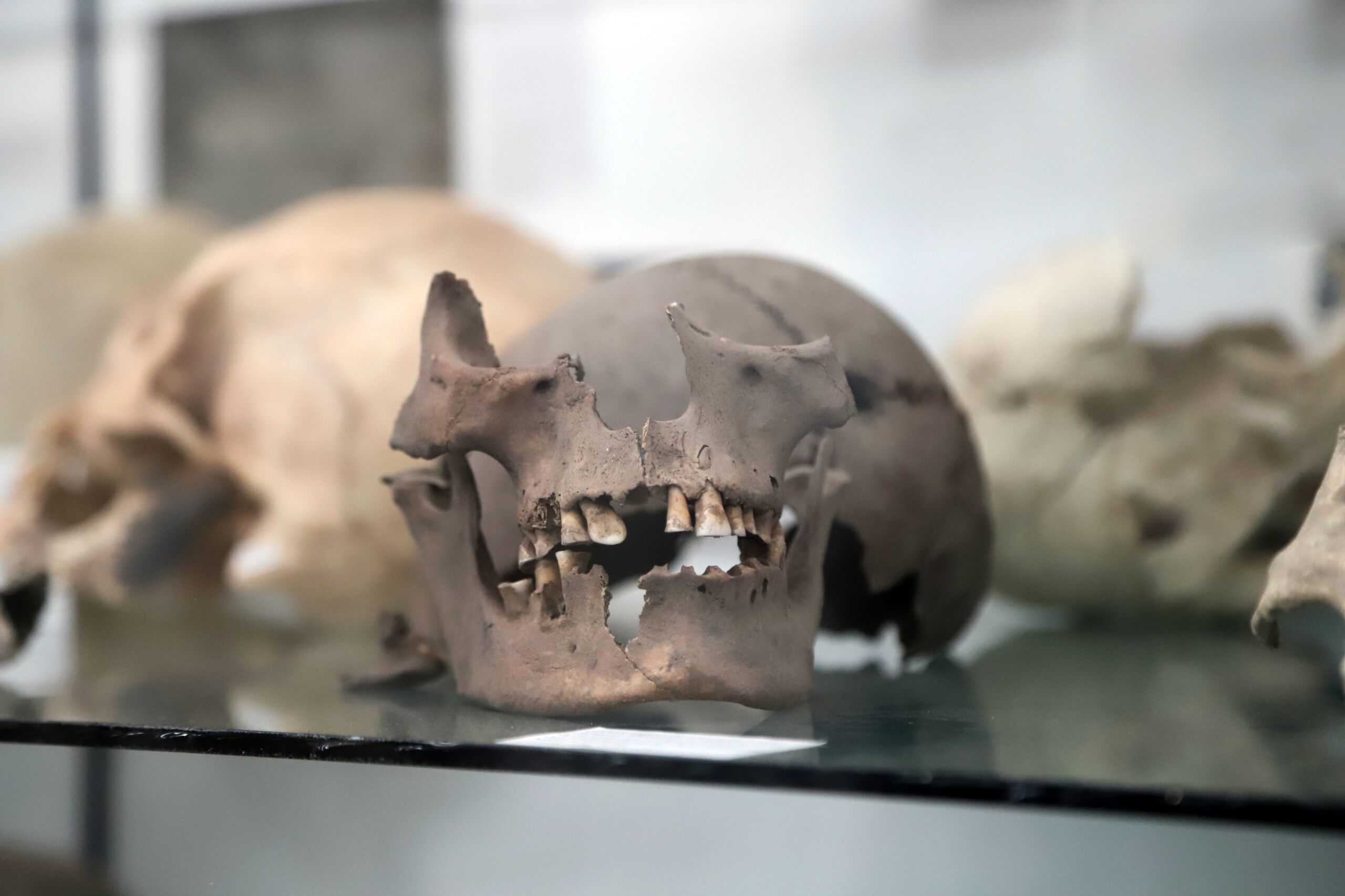 Forensic,Anthropology.,Human,Bone,Remains,For,Study,In,A,Laboratory
